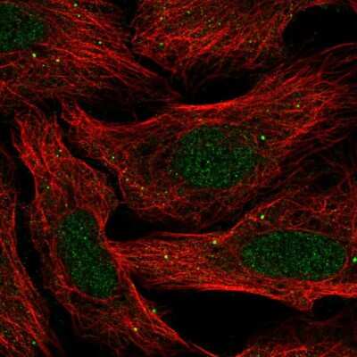 Immunocytochemistry/ Immunofluorescence: SLC30A3 Antibody [NBP2-56640]