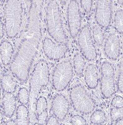 Immunohistochemistry-Paraffin: SLC30A3 Antibody [NBP2-31825]