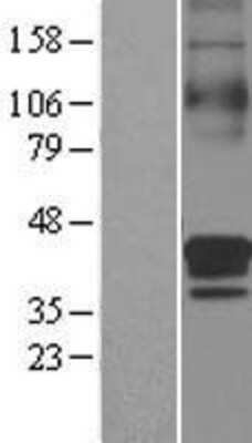 Western Blot: SLC30A3 Overexpression Lysate [NBL1-16107]