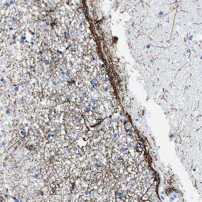 Immunohistochemistry: SLC30A4 Antibody [NBP1-86824]