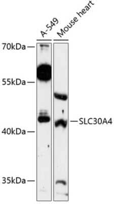 Western Blot: SLC30A4 AntibodyAzide and BSA Free [NBP2-94290]