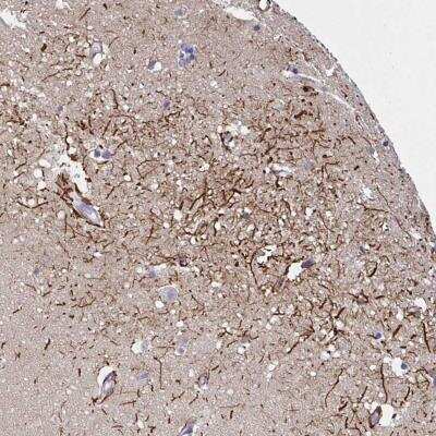 Immunohistochemistry-Paraffin: SLC30A6 Antibody [NBP2-31673]