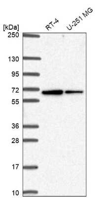 Western Blot: SLC30A6 Antibody [NBP2-31673]