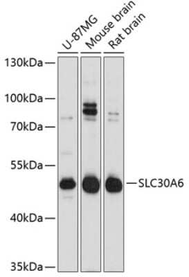 Western Blot: SLC30A6 AntibodyAzide and BSA Free [NBP2-93596]