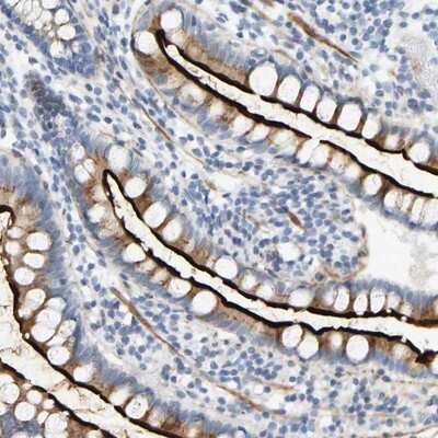 Immunohistochemistry-Paraffin: SLC30A7 Antibody [NBP1-80578]