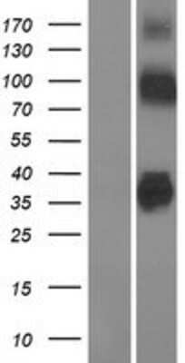 Western Blot: ZnT-8/SLC30A8 Overexpression Lysate [NBP2-05081]