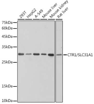 Western Blot: SLC31A1/CTR1 Antibody (4C10C5) [NBP3-15304]