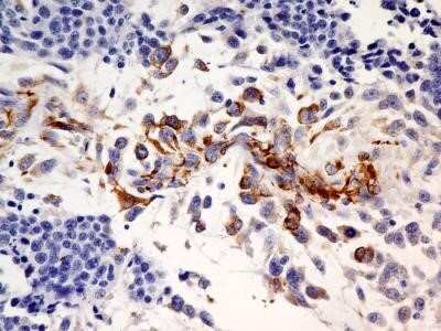 Immunohistochemistry: SLC31A1/CTR1 Antibody (5E6.1B4) - Azide and BSA Free [NBP2-80951]