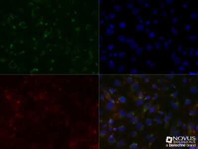 Immunocytochemistry/ Immunofluorescence: SLC31A1/CTR1 Antibody (5E6.1B4) - BSA Free [NBP2-36573]