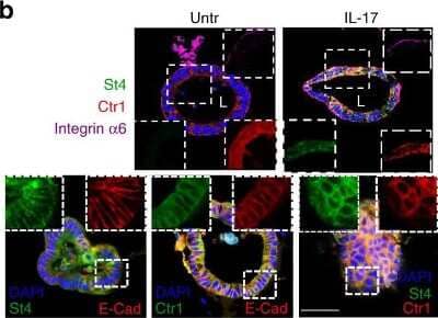 Immunohistochemistry: SLC31A1/CTR1 Antibody (5E6.1B4) - BSA Free [NBP2-36573]