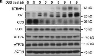 Western Blot: SLC31A1/CTR1 Antibody (5E6.1B4)BSA Free [NBP2-36573]