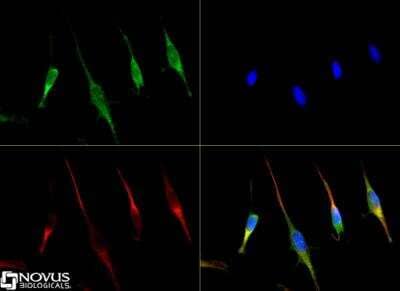 Immunocytochemistry/ Immunofluorescence: SLC31A1/CTR1 Antibody [NB100-402]