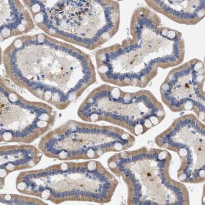 Immunohistochemistry-Paraffin: SLC31A1/CTR1 Antibody [NBP1-84405]