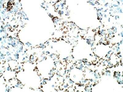 Immunohistochemistry-Paraffin: SLC31A1/CTR1 Antibody [NBP3-12348]