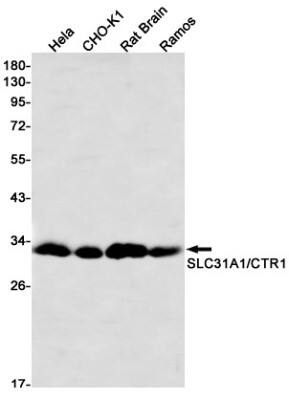 Western Blot: SLC31A1/CTR1 Antibody (S06-7G0) [NBP3-19918]