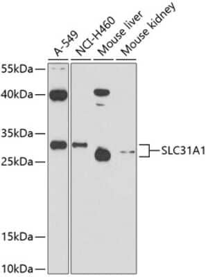 Western Blot: SLC31A1/CTR1 AntibodyBSA Free [NBP2-93123]