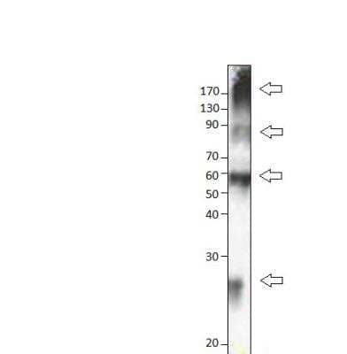 Western Blot: SLC31A1/CTR1 Antibody [NBP3-12348]