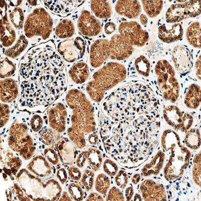 Immunohistochemistry-Paraffin: SLC34A1 Antibody (10B1.3E9) - BSA Free [NBP2-42216]