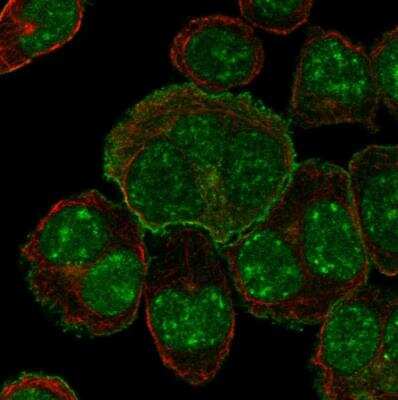 Immunocytochemistry/ Immunofluorescence: SLC34A1 Antibody [NBP2-13328]