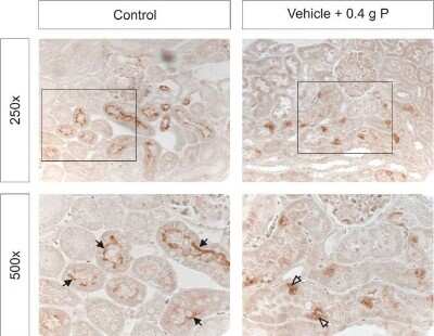 Immunohistochemistry: SLC34A1 Antibody [NBP2-13328]