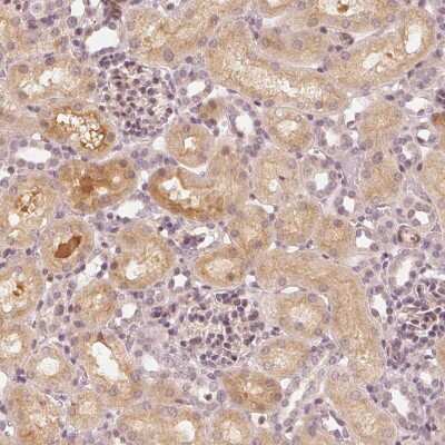 Immunohistochemistry-Paraffin: SLC34A1 Antibody [NBP2-13328]