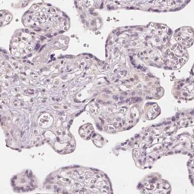 Immunohistochemistry-Paraffin: SLC34A1 Antibody [NBP2-13328]