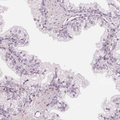 Immunohistochemistry-Paraffin: SLC34A1 Antibody [NBP2-13328]