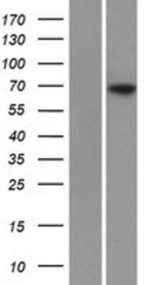 Western Blot: SLC34A1 Overexpression Lysate [NBP2-08042]