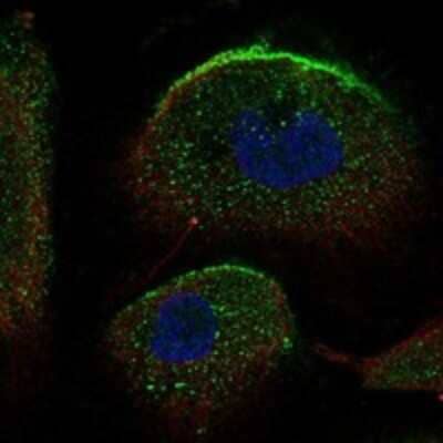 Immunocytochemistry/ Immunofluorescence: SLC34A2 Antibody [NBP3-17541]