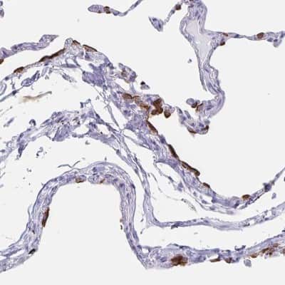 Immunohistochemistry-Paraffin: SLC34A2 Antibody [NBP1-81013]
