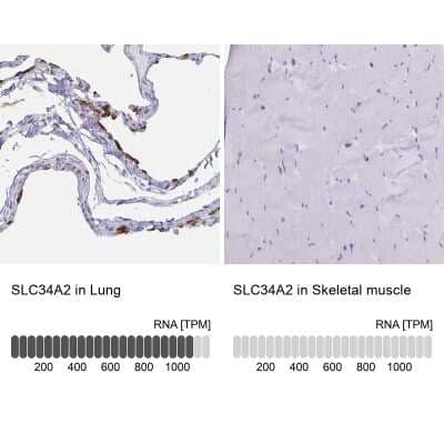 Immunohistochemistry-Paraffin: SLC34A2 Antibody [NBP1-81013]