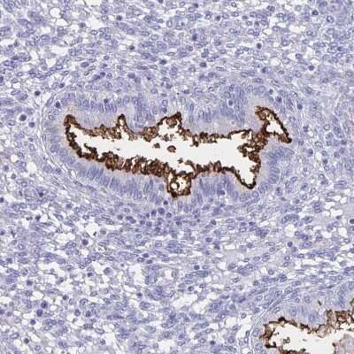 Immunohistochemistry-Paraffin: SLC34A2 Antibody [NBP1-81013]