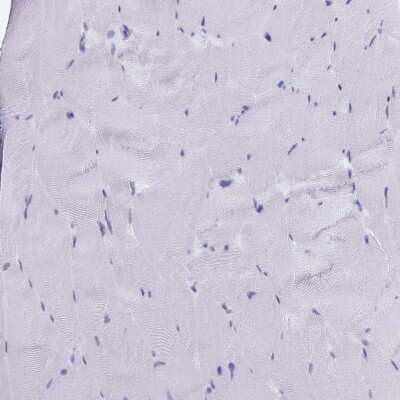 Immunohistochemistry-Paraffin: SLC34A2 Antibody [NBP1-81013]
