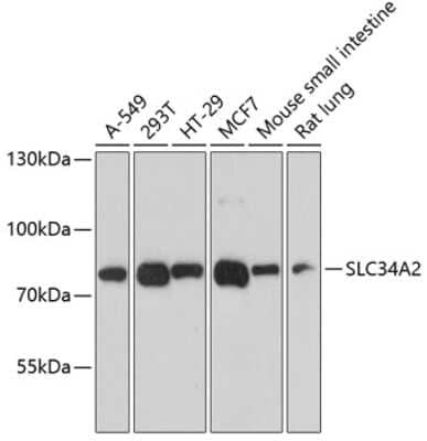 Western Blot: SLC34A2 AntibodyAzide and BSA Free [NBP2-93293]