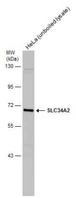 Western Blot: SLC34A2 Antibody [NBP3-12982]