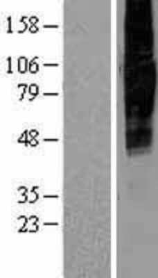 Western Blot: SLC34A2 Overexpression Lysate [NBP2-04311]