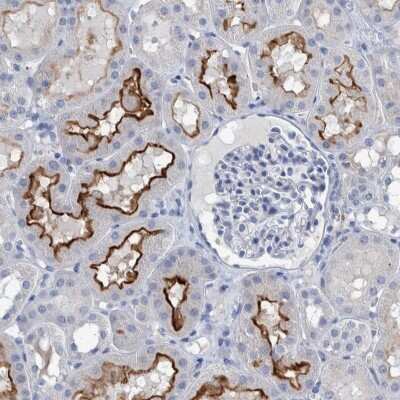 Immunohistochemistry-Paraffin: SLC34A3 Antibody [NBP1-81933]