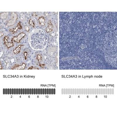 Immunohistochemistry-Paraffin: SLC34A3 Antibody [NBP1-81933]