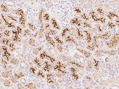 Immunohistochemistry-Paraffin: SLC34A3 Antibody [NBP3-06366]