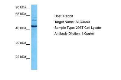 Western Blot: SLC34A3 Antibody [NBP1-79976]