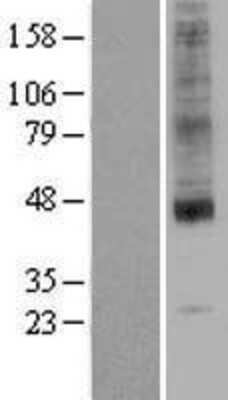 Western Blot: SLC35A1 Overexpression Lysate [NBL1-16115]