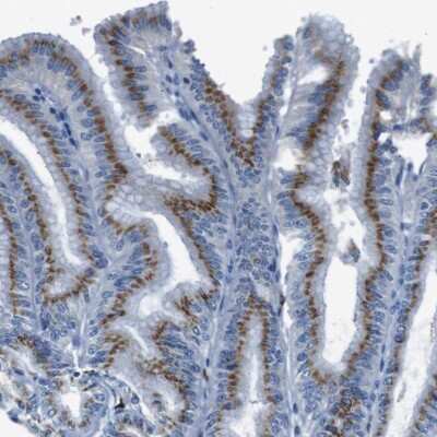 Immunohistochemistry-Paraffin: SLC35A3 Antibody [NBP1-86458]