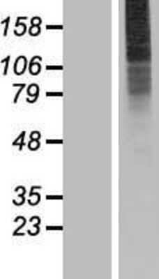 Western Blot: SLC35A3 Overexpression Lysate [NBP2-07471]