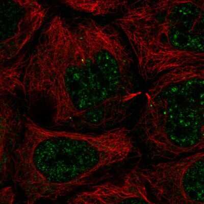 Immunocytochemistry/ Immunofluorescence: SLC35A4 Antibody [NBP2-56943]