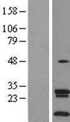 Western Blot: SLC35A4 Overexpression Lysate [NBL1-16117]