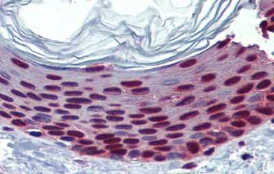 Immunohistochemistry-Paraffin: SLC35A5 Antibody [NBP1-62284]