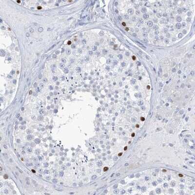 Immunohistochemistry-Paraffin: SLC35A5 Antibody [NBP1-83636]