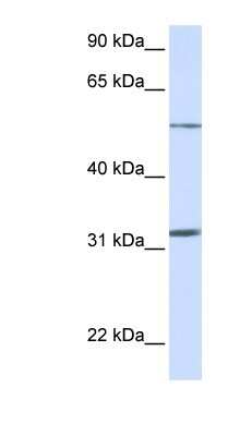 Western Blot: SLC35A5 Antibody [NBP1-62284]