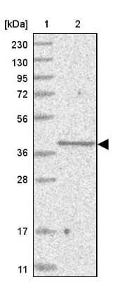 Western Blot: SLC35A5 Antibody [NBP1-83636]