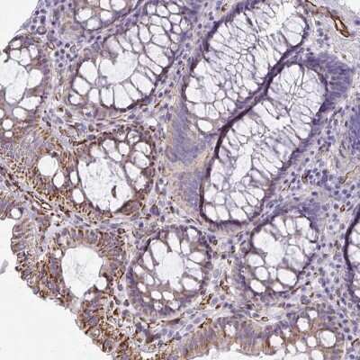 Immunohistochemistry: SLC35B1 Antibody [NBP2-31677]
